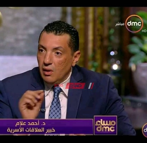 أحمد علام لـ صباح مصر: الغيرة عند النساء سبب الإصابة بالسكر والضغط
