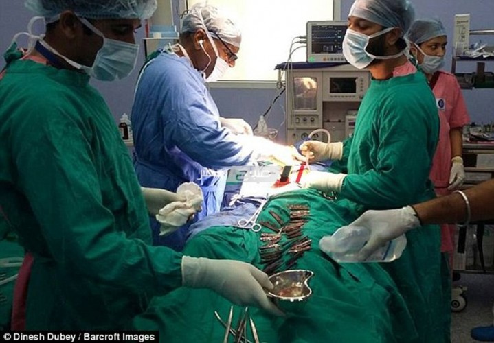 إعادة “كف” مريض ليده بعد بترها في عملية جراحية بمستشفى الأزهر بدمياط
