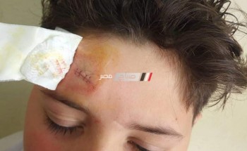 في معهد ازهري بدمياط إصابة تلميذ بجرح قطعي بالوجه على يد معلمته … صور