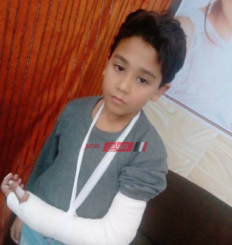 معلمة تكسر ذراع طالب داخل مدرسة ابتدائية في دمياط