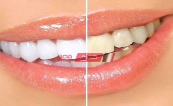 طريقة عمل وصفة طبيعية لتبيض الأسنان في دقيقتين