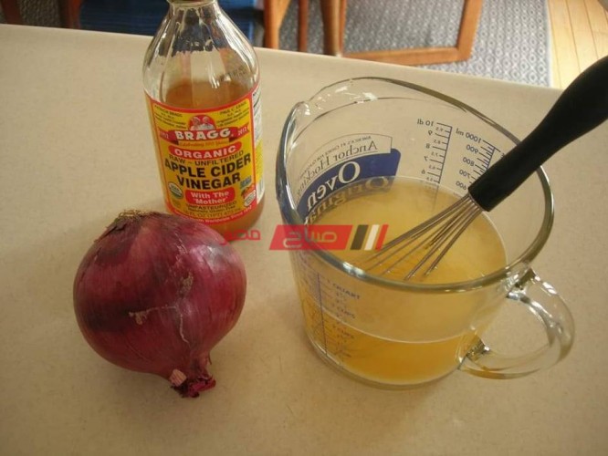 عصير البصل للتخلص من النمش والبقع الداكنة