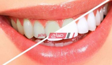 وصفات منزلية طبيعية لتبييض الأسنان