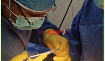 لأول مرة .. وكيل الصحة في السويس يجري عملية جراحية لإستئصال ورم مسخي علي المبيض