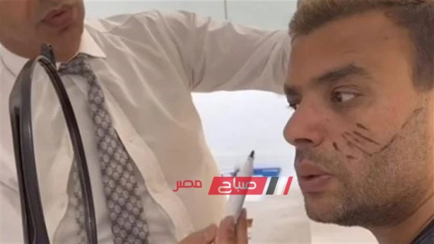 رامي صبري يخضع لجراحة تجميل الوجه في لبنان