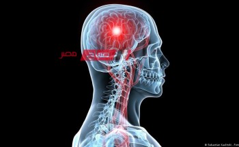 علاج السكتة الدماغية: ما هي المساعدة التي يحتاجها المريض؟