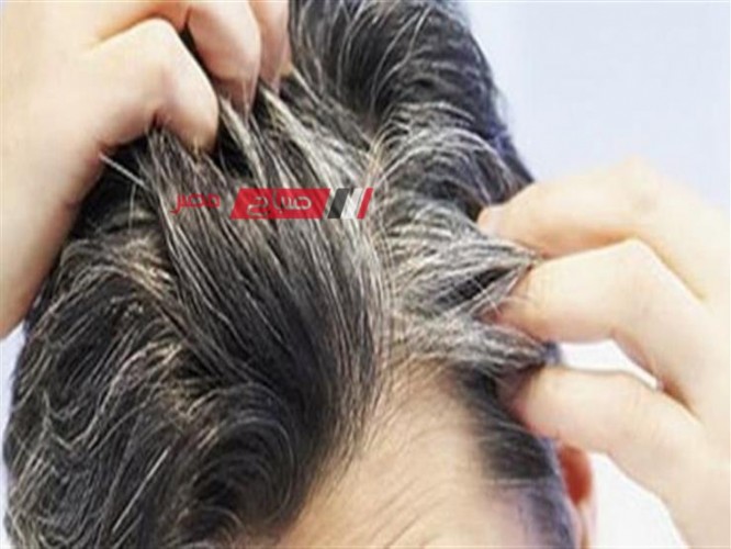 علاج ظهور الشعر الأبيض في سن الثلاثين